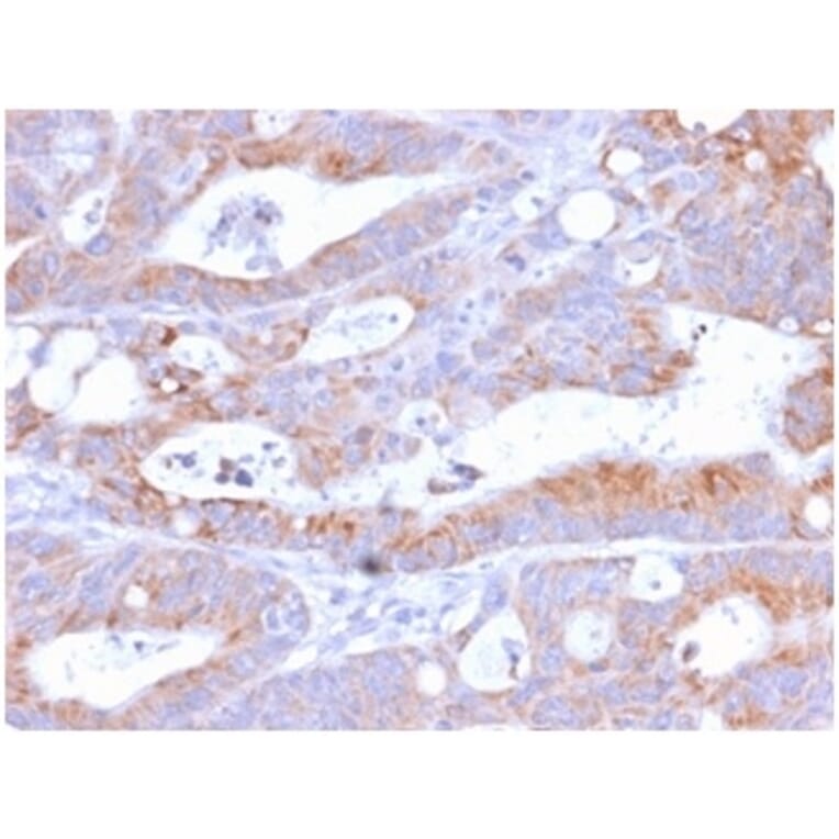 Immunohistochemistry - Anti-NULL Antibody [C86/2160R] (A250648) - Antibodies.com