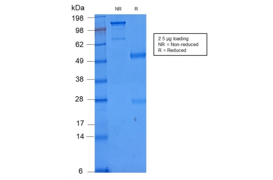 SDS-PAGE - Anti-NULL Antibody [C86/2160R] (A250648) - Antibodies.com