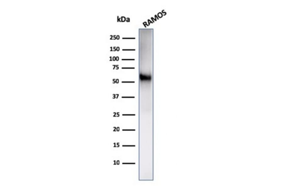 Western Blot - Anti-NULL Antibody [C86/2160R] (A250648) - Antibodies.com