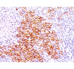 Immunohistochemistry - Anti-CD30 Antibody [CD30/412] (A250649) - Antibodies.com