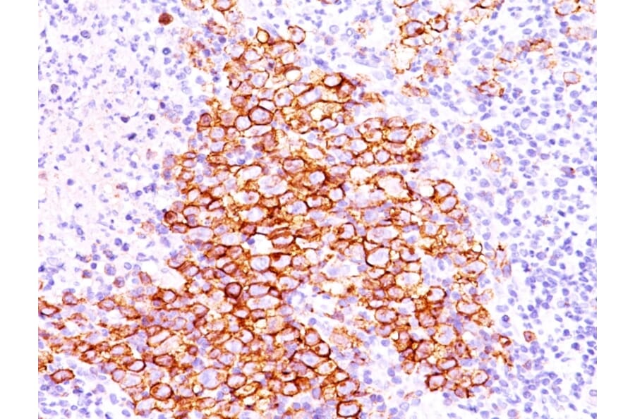 Immunohistochemistry - Anti-CD30 Antibody [CD30/412] (A250649) - Antibodies.com