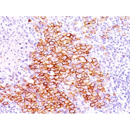 Immunohistochemistry - Anti-CD30 Antibody [CD30/412] (A250649) - Antibodies.com