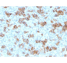 Immunohistochemistry - Anti-CD30 Antibody [Ki-1/779] (A250649) - Antibodies.com