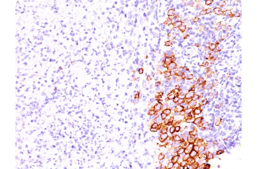 Immunohistochemistry - Anti-CD30 Antibody [SPM609] (A250650) - Antibodies.com