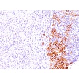 Immunohistochemistry - Anti-CD30 Antibody [SPM609] (A250650) - Antibodies.com