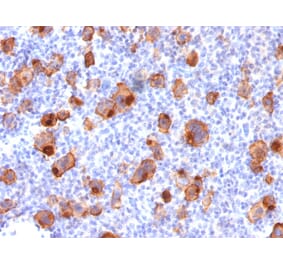 Immunohistochemistry - Anti-CD30 Antibody [rKi-1/779] (A250651) - Antibodies.com