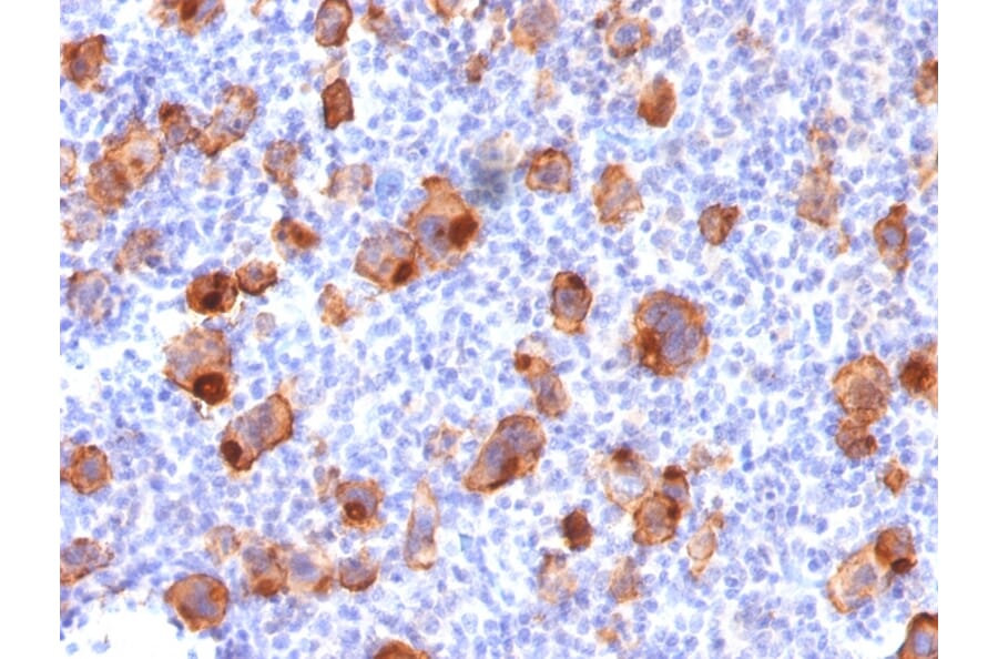 Immunohistochemistry - Anti-CD30 Antibody [rKi-1/779] (A250651) - Antibodies.com