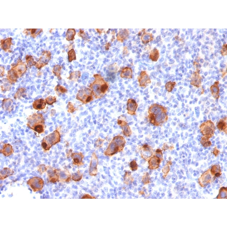 Immunohistochemistry - Anti-CD30 Antibody [rKi-1/779] (A250651) - Antibodies.com