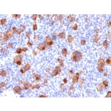 Immunohistochemistry - Anti-CD30 Antibody [rKi-1/779] (A250651) - Antibodies.com