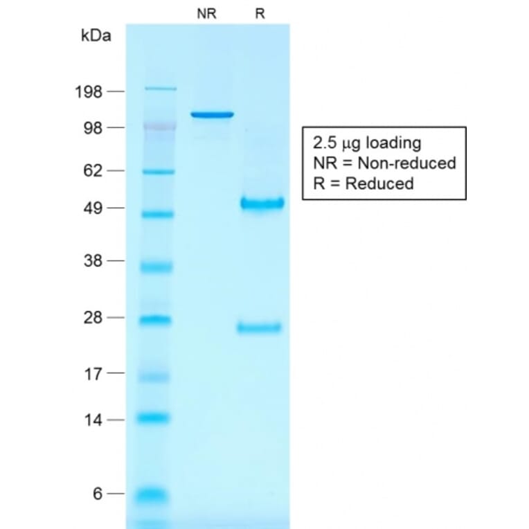 SDS-PAGE - Anti-CD30 Antibody [rKi-1/779] (A250652) - Antibodies.com