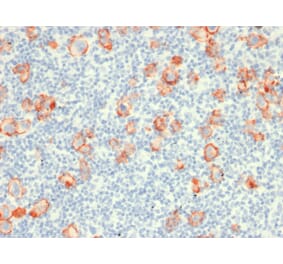 Immunohistochemistry - Anti-CD30 Antibody [rCD30/412] (A250652) - Antibodies.com