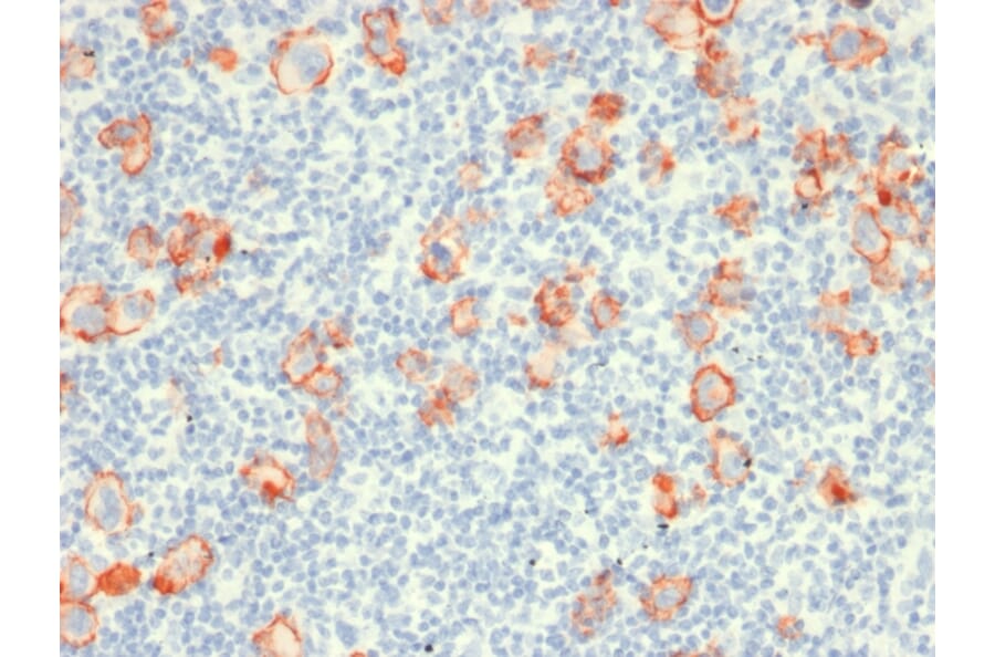 Immunohistochemistry - Anti-CD30 Antibody [rCD30/412] (A250652) - Antibodies.com