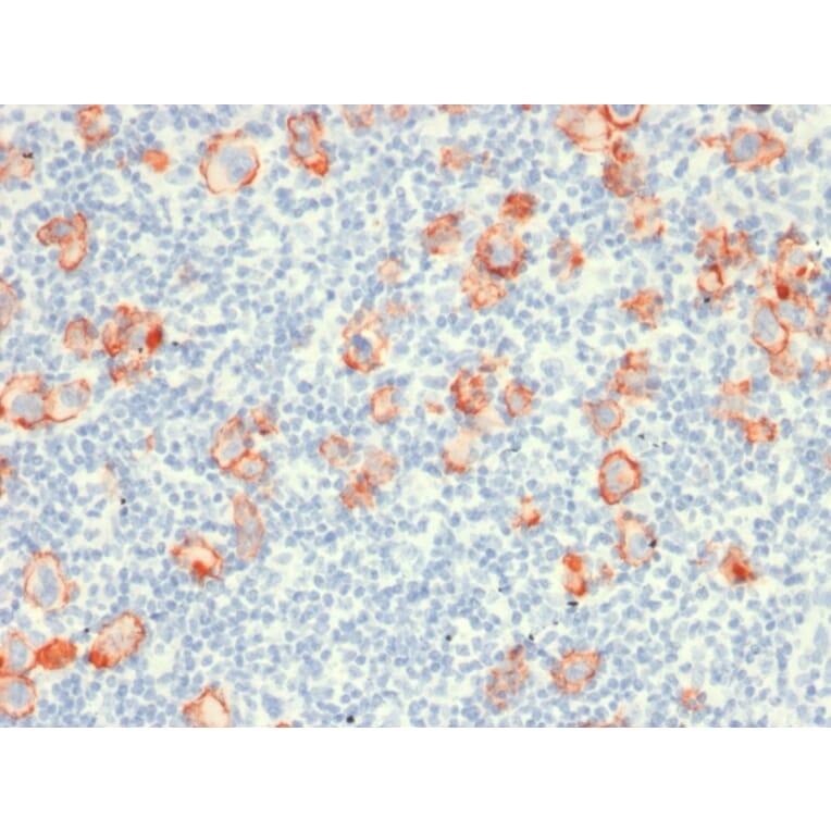 Immunohistochemistry - Anti-CD30 Antibody [rCD30/412] (A250652) - Antibodies.com