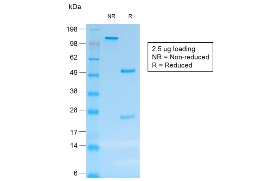 SDS-PAGE - Anti-CD30 Antibody [rCD30/412] (A250653) - Antibodies.com