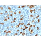 Immunohistochemistry - Anti-CD30 Antibody [Ki-1/4399R] (A250653) - Antibodies.com