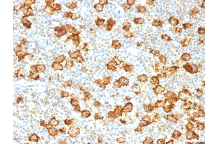 Immunohistochemistry - Anti-CD30 Antibody [Ki-1/1505R] (A250654) - Antibodies.com
