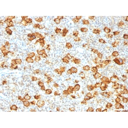 Immunohistochemistry - Anti-CD30 Antibody [Ki-1/1505R] (A250654) - Antibodies.com