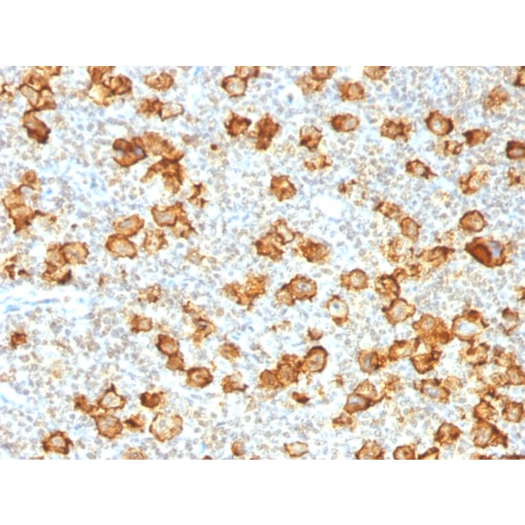Immunohistochemistry - Anti-CD30 Antibody [Ki-1/1505R] (A250654) - Antibodies.com