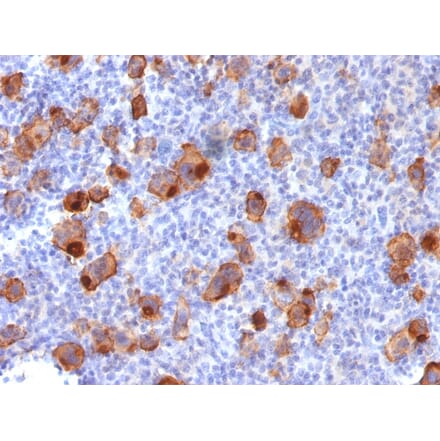 Immunohistochemistry - Anti-CD30 Antibody [Ki-1/1747R] (A250655) - Antibodies.com