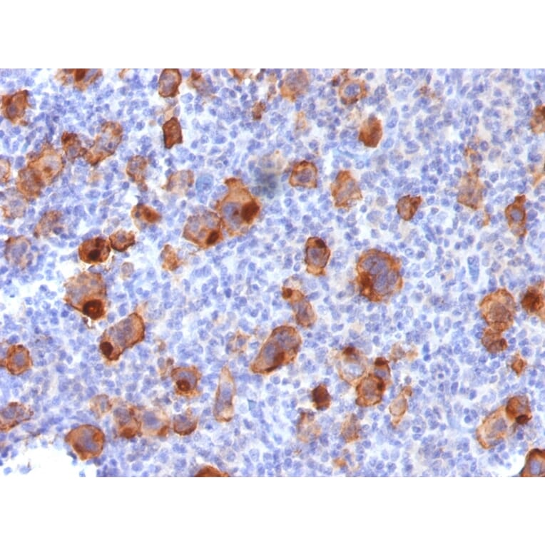 Immunohistochemistry - Anti-CD30 Antibody [Ki-1/1747R] (A250655) - Antibodies.com