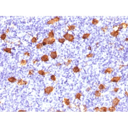 Immunohistochemistry - Anti-CD30 Antibody (A250656) - Antibodies.com