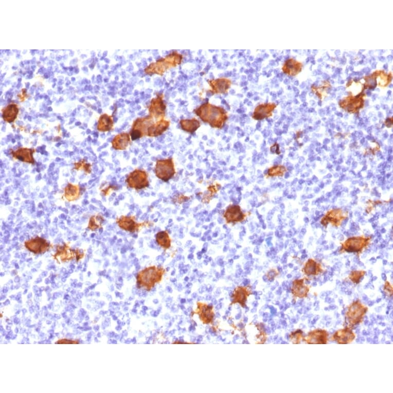 Immunohistochemistry - Anti-CD30 Antibody (A250656) - Antibodies.com