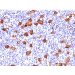 Immunohistochemistry - Anti-CD30 Antibody (A250656) - Antibodies.com