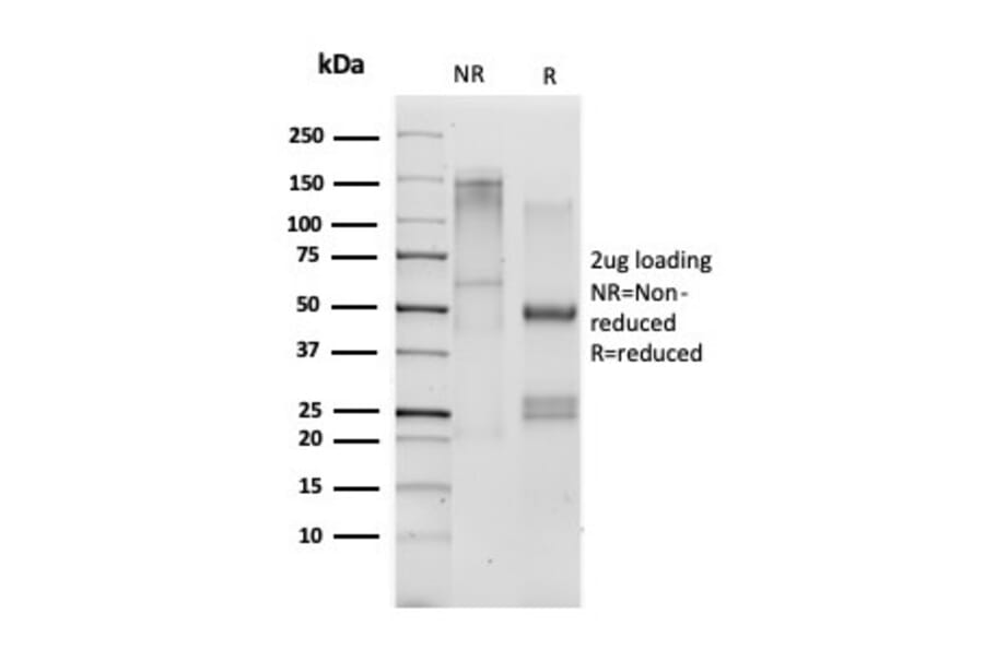 SDS-PAGE - Anti-CD33 Antibody [SIGLEC3/3600] (A250658) - Antibodies.com