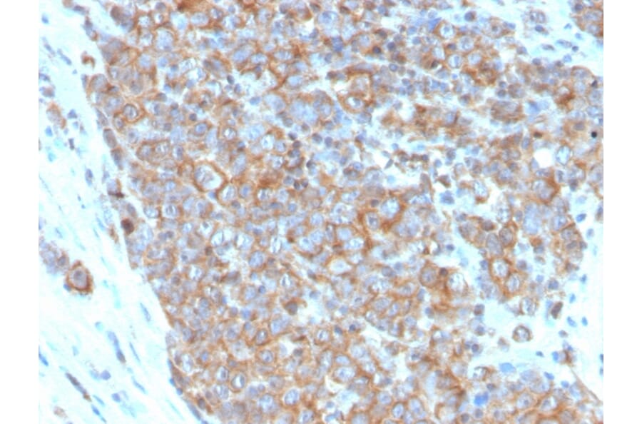 Immunohistochemistry - Anti-CD33 Antibody [SIGLEC3/3600] (A250658) - Antibodies.com