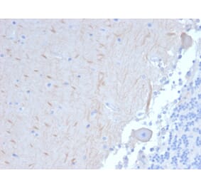 Immunohistochemistry - Anti-ATG5 Antibody [ATG5/2101] (A250660) - Antibodies.com