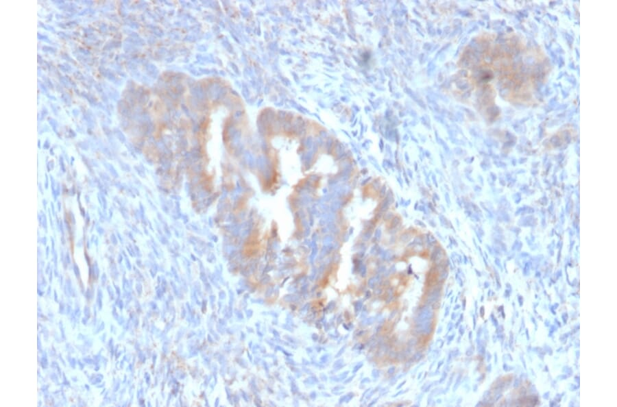 Immunohistochemistry - Anti-ATG5 Antibody [ATG5/2101] (A250660) - Antibodies.com