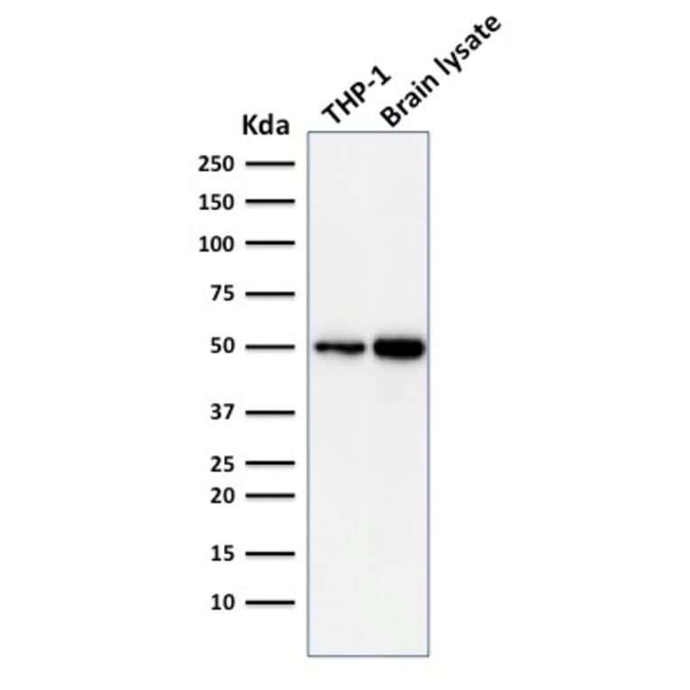 Western Blot - Anti-ATG5 Antibody [ATG5/2101] (A250660) - Antibodies.com