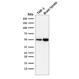 Western Blot - Anti-ATG5 Antibody [ATG5/2101] (A250660) - Antibodies.com