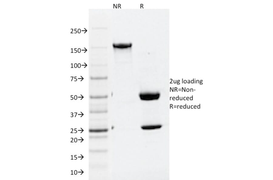 SDS-PAGE - Anti-ATG5 Antibody [ATG5/2101] (A250660) - Antibodies.com