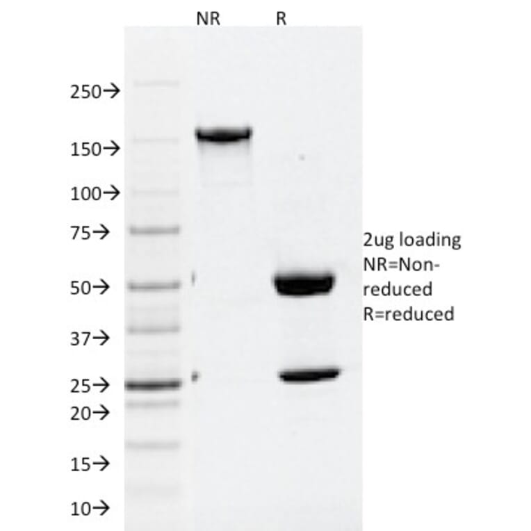 SDS-PAGE - Anti-ATG5 Antibody [ATG5/2101] (A250660) - Antibodies.com