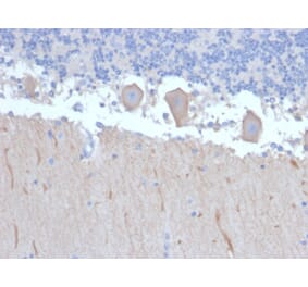 Immunohistochemistry - Anti-ATG5 Antibody [ATG5/2492] (A250660) - Antibodies.com