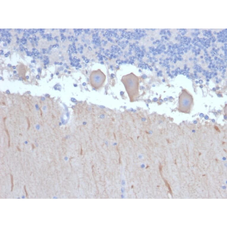 Immunohistochemistry - Anti-ATG5 Antibody [ATG5/2492] (A250660) - Antibodies.com
