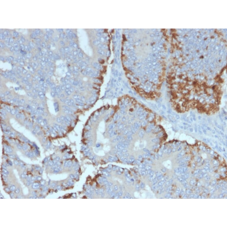 Immunohistochemistry - Anti-ATG5 Antibody [ATG5/2492] (A250661) - Antibodies.com