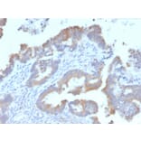 Immunohistochemistry - Anti-ATG5 Antibody [ATG5/2492] (A250661) - Antibodies.com