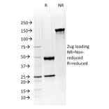 SDS-PAGE - Anti-ATG5 Antibody [ATG5/2492] (A250661) - Antibodies.com