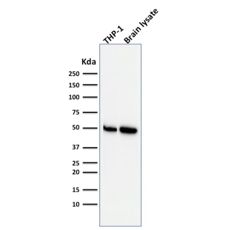 Western Blot - Anti-ATG5 Antibody [ATG5/2553] (A250662) - Antibodies.com