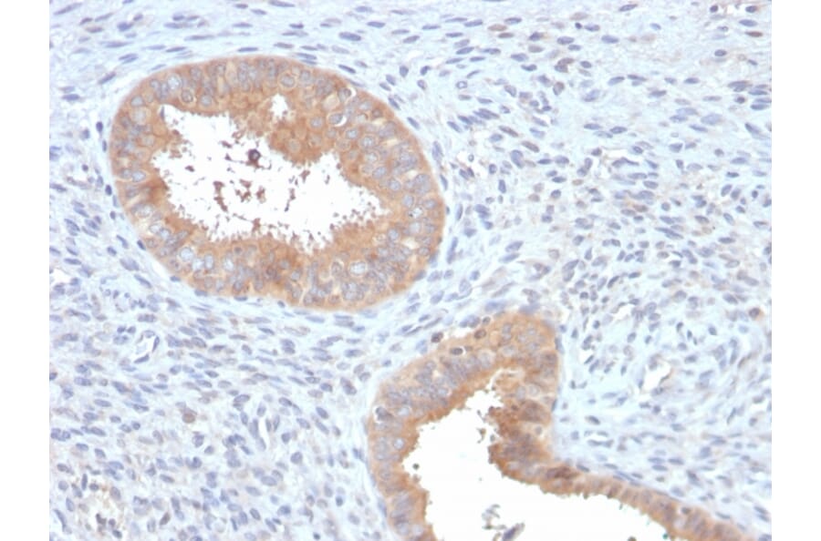 Immunohistochemistry - Anti-ATG5 Antibody [ATG5/2553] (A250662) - Antibodies.com