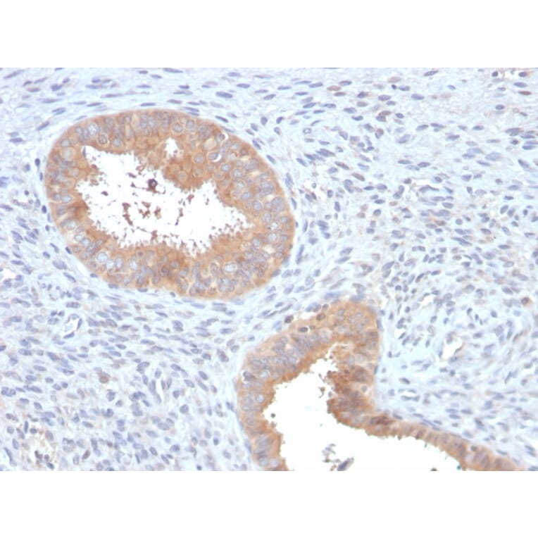 Immunohistochemistry - Anti-ATG5 Antibody [ATG5/2553] (A250662) - Antibodies.com