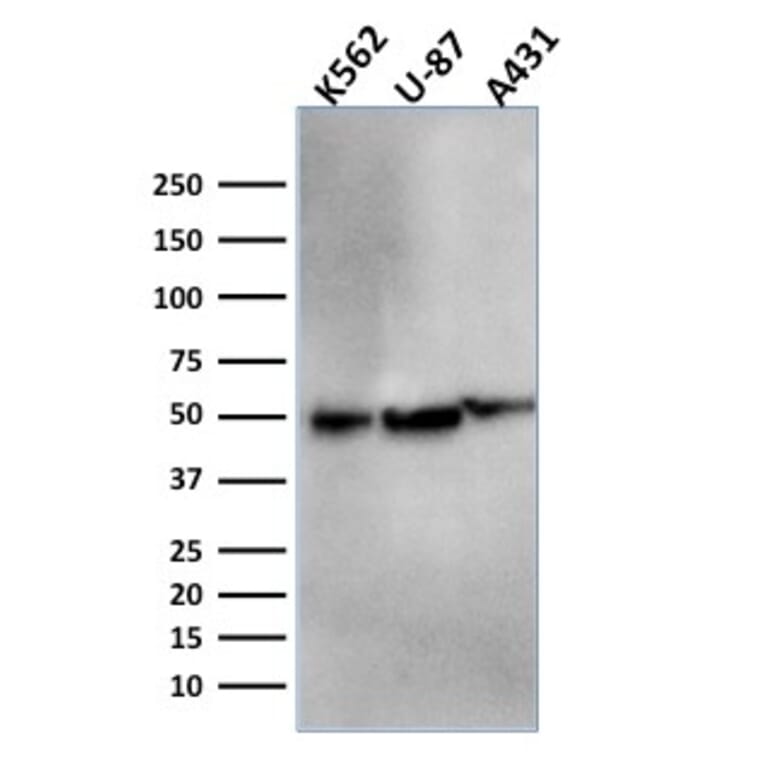 Western Blot - Anti-ATG5 Antibody [ATG5/2553] (A250662) - Antibodies.com