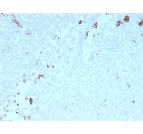 Immunohistochemistry - Anti-ATG5 Antibody [rATG5/2553] (A250663) - Antibodies.com