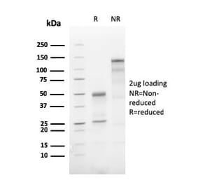 SDS-PAGE - Anti-ATG5 Antibody [AGT5/3220R] (A250663) - Antibodies.com