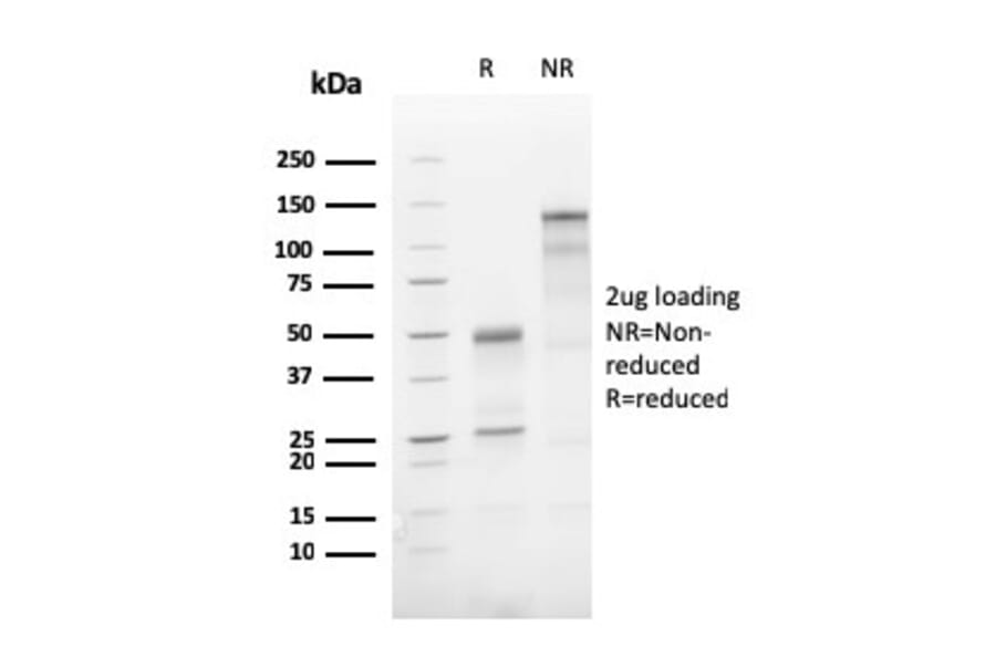 SDS-PAGE - Anti-ATG5 Antibody [AGT5/3220R] (A250663) - Antibodies.com