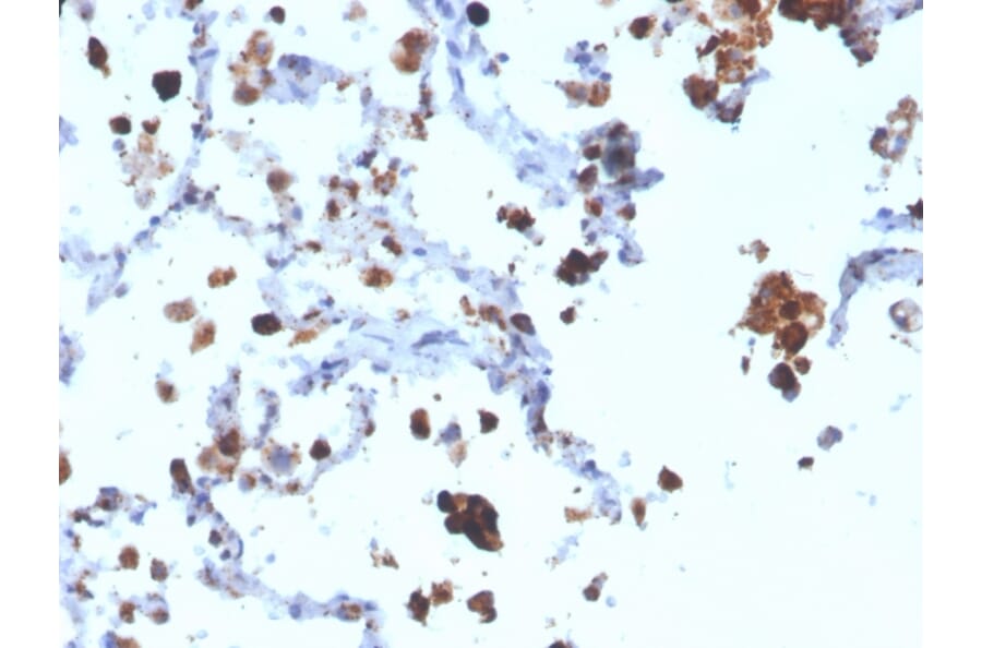 Immunohistochemistry - Anti-NAPSIN A Antibody [NAPSA/3308] (A250665) - Antibodies.com