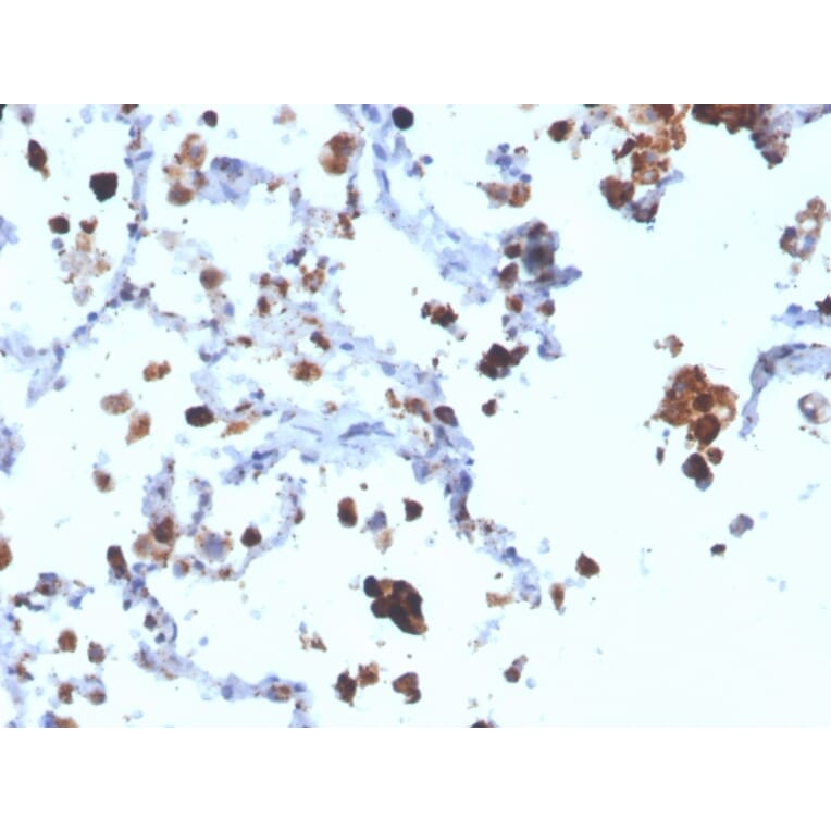 Immunohistochemistry - Anti-NAPSIN A Antibody [NAPSA/3308] (A250665) - Antibodies.com