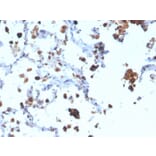 Immunohistochemistry - Anti-NAPSIN A Antibody [NAPSA/3308] (A250665) - Antibodies.com